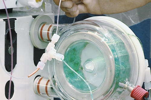 Wenn Artemisinin künstlich entsteht, dann kommt es zu einer farbenfrohen Reaktion: Aus der violetten Artemisininsäure entsteht grünes Artemisinin.