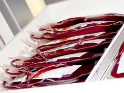 Blutkonserven aus dem Ausland